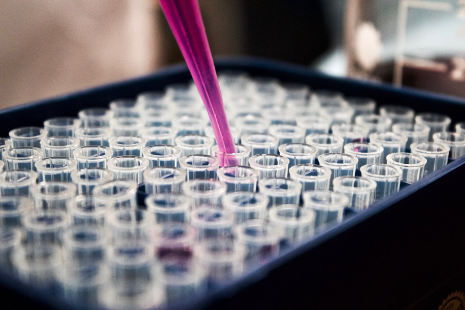 Pippet dropping liquid into test tube